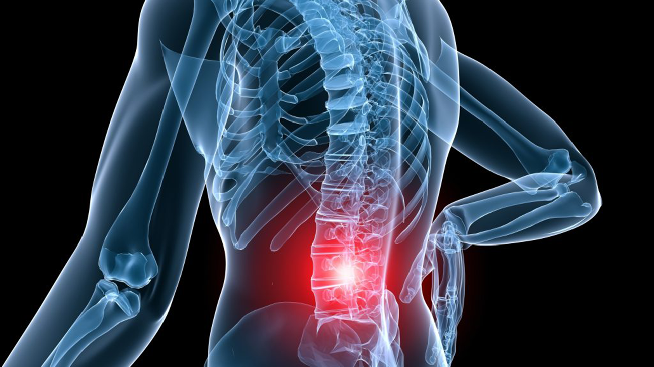 世田谷区ヘルニア整体