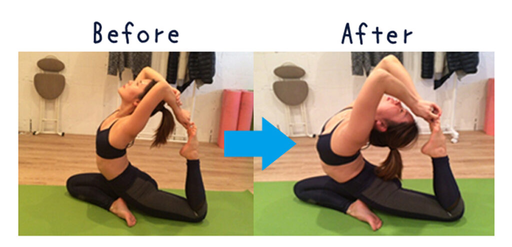 世田谷区衝撃波治療