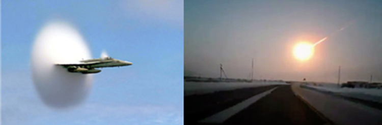 世田谷区衝撃波治療