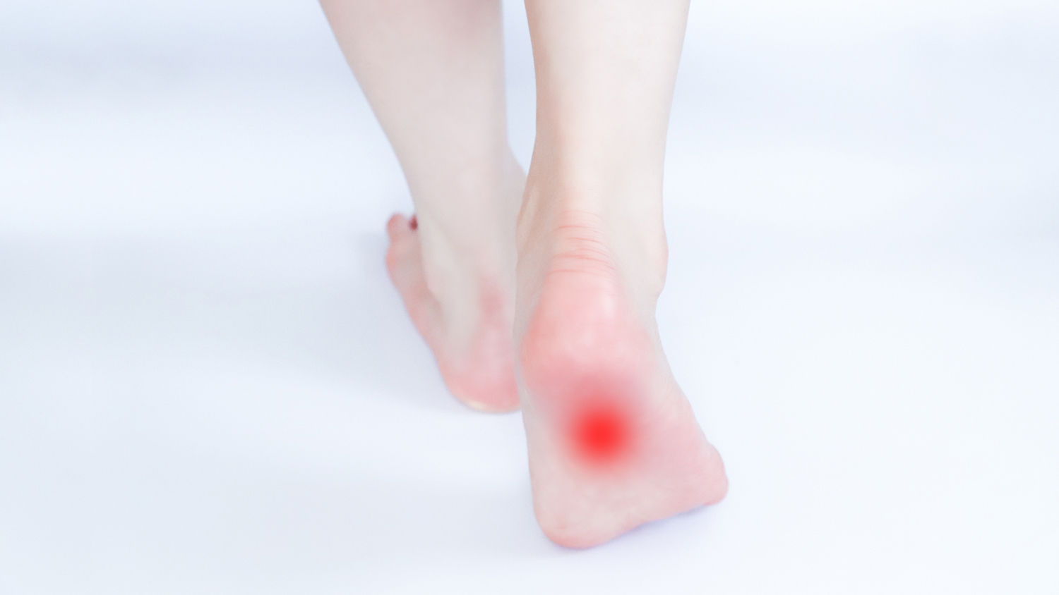 世田谷区足底筋膜炎