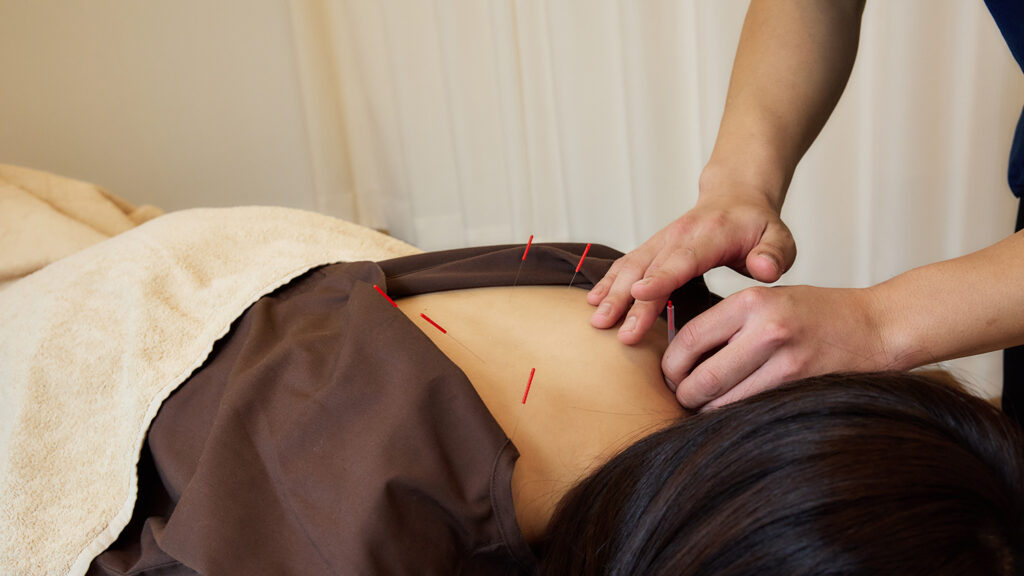 世田谷区肩こり整体